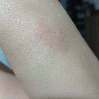 Bengisu Yasemin Zehir Beauty Center Ne İade Yapıldı Ne De Herhangi Bir Geri Dönüş Sağlandı
