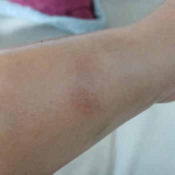 Bengisu Yasemin Zehir Beauty Center Ne İade Yapıldı Ne De Herhangi Bir Geri Dönüş Sağlandı