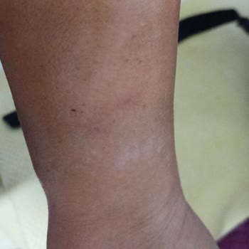 Bengisu Yasemin Zehir Beauty Center Ne İade Yapıldı Ne De Herhangi Bir Geri Dönüş Sağlandı