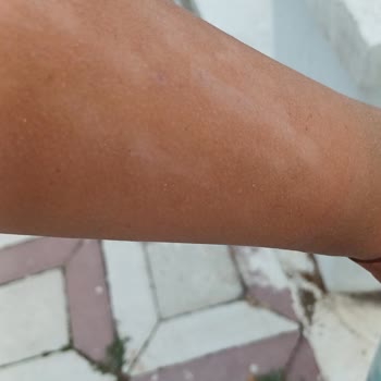 Bengisu Yasemin Zehir Beauty Center Ne İade Yapıldı Ne De Herhangi Bir Geri Dönüş Sağlandı