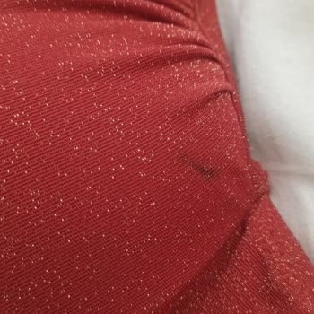 Kusurlu Bikini İadesi Reddi Ve Müşteri Mağduriyeti