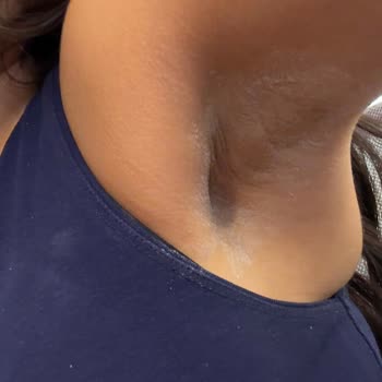 Yves Rocher Antiperspirant Beyaz Leke Bırakıyor, Değişim İstiyorum