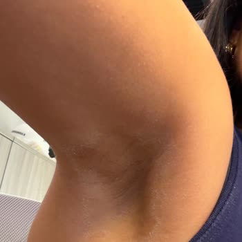 Yves Rocher Antiperspirant Beyaz Leke Bırakıyor, Değişim İstiyorum