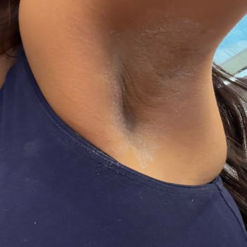 Yves Rocher Antiperspirant Beyaz Leke Bırakıyor, Değişim İstiyorum