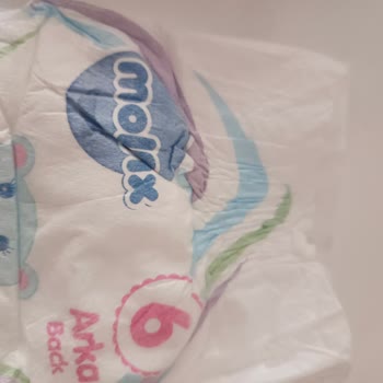 Molfix 6 Numaralı Bebek Bezlerinde Üretim Farkı Ve Sızdırma Problemi
