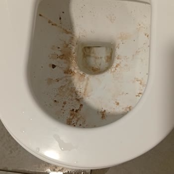 İzmir Bayraklı Şehir Hastanesi Hijyenin Önemsenmemesi