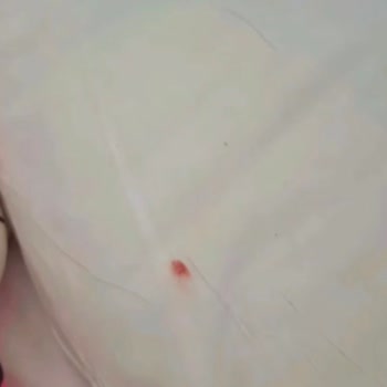 Otele Girişte Saatlerce Beklemek, Kötü Yemek Ve Hijyen, Güvenlik Sorunları