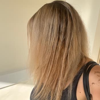 Saç Açma İşleminde Yanık Ve Saç Dökülmesi, Personelin Alaycı Yaklaşımı