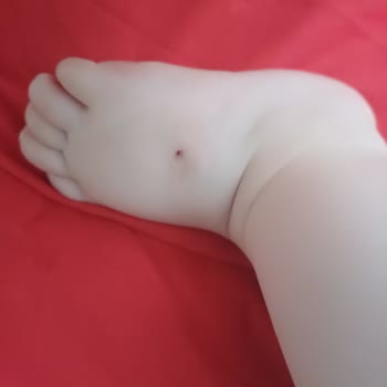 1 Yaşındaki Kızımın Kan Alımında 8 Deneme Ve Gereksiz Tüp Alımı
