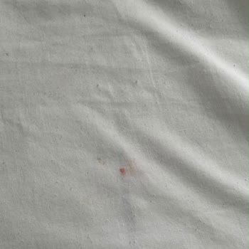 Ares Blue Hotel'de Yiyecek Zehirlenmesi Ve Hijyen Sorunları