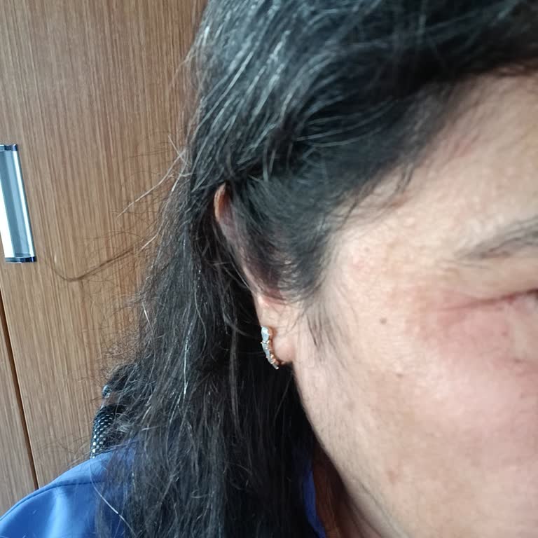 Yanıltıcı Ürün Tavsiyesi Ve Alerjik Reaksiyon Sonrası 9000 TL İade Ve Özür Talebi