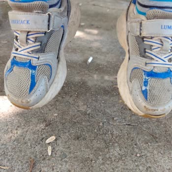 Ayakkabının Kısa Sürede Deforme Olması Ve Garanti Reddi