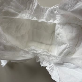Yeni Bebek Bezinde Sert Yabancı Cisim Bulunması Ve Güven Kaybı