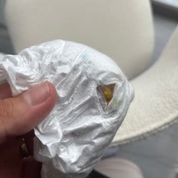 Yeni Bebek Bezinde Sert Yabancı Cisim Bulunması Ve Güven Kaybı