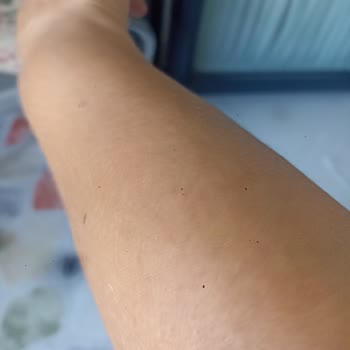 Patlayan Kapak Ve Yüksek Ses Sonrası Garanti Reddi Kabul Edilemez