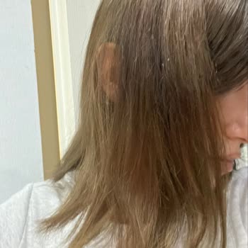Uzun Bekleme Ve Yanlış Renk Sonucu Nedeniyle İade Talebi