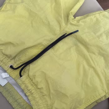 Lacoste Erkek Sarı Şortun Hızlı Renk Solması Ve Kalite Sorunu