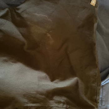 Koltuk Altı Bölgesinde Renk Açılması Ve Dalgalı Lekelenme Sorunu