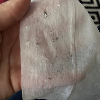 Bebek Mendilinde Siyah Lekeler: Hijyen Ve Güven Sorunu