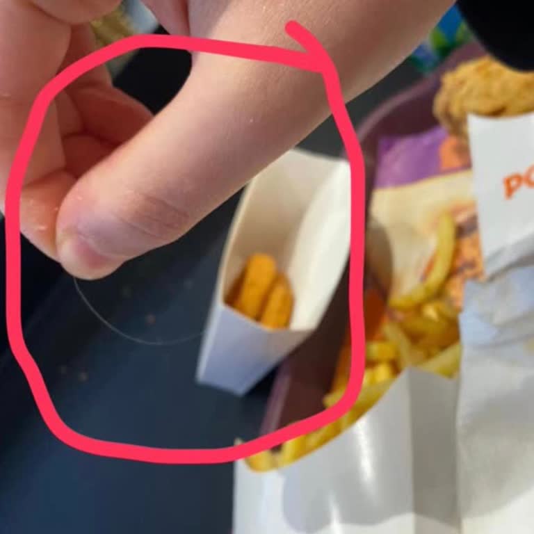 Hamburgerde Kıl Bulunması Ve Saygısız Müşteri Hizmetine Karşı Tam İade Talebi