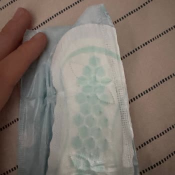 Molped Nioli Yağlı Günlük Pedlerde Kaşıntı Ve Şişlik Şikayeti