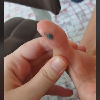 Mavi Renkli Tortular İçeren Sodada Hijyen İhlali