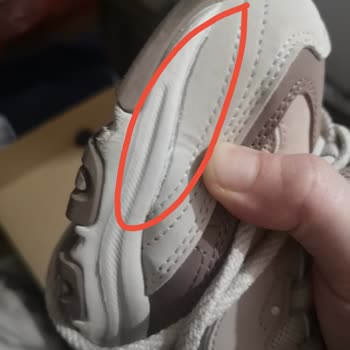 Skechers Ayakkabılarında Erken Yırtılma Ve Şirketin Umursamaz Tutumu