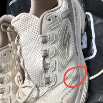 Skechers Ayakkabılarında Erken Yırtılma Ve Şirketin Umursamaz Tutumu