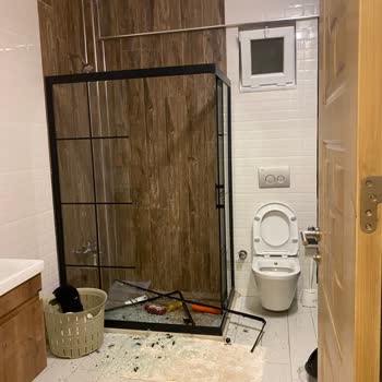 Villa Sepeti'nde Patlayan Duşakabinin Camı Çocuğumuza Ağır Yaralanma Getirdi Ve Destek Sunmadı
