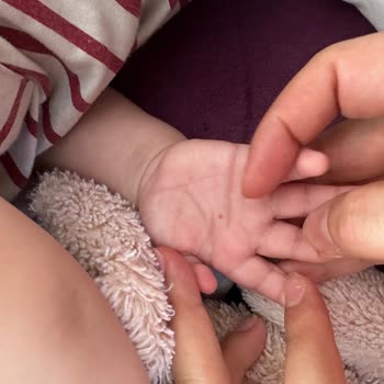 Bebekte Çoklu Delik İzleri Hemşire Hatası Ve İdari Soruşturma Talebi