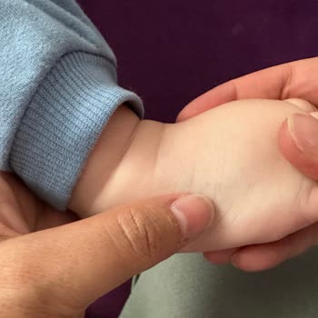 Bebekte Çoklu Delik İzleri Hemşire Hatası Ve İdari Soruşturma Talebi