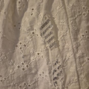 Gizli Ütü Yanığı Defosu Ve Satıcı Desteğinin Cevapsız Kalması