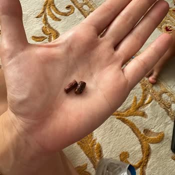 Çikolatanın İçinde Sert Yabancı Cisim Çıktı, Dişim Ağrıdı Ve İade Bekliyorum