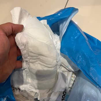 Islak Ve Şişmiş Bebek Bezleri İçin Geri Ödeme Talebi