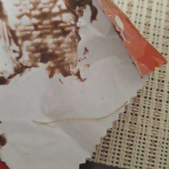 Ülker Çokonat'ta Dilde Yabancı Cisim