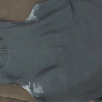 Ücretsiz Roll-Onun Bembeyaz Lekeler Ve Kaşıntı Sorunu