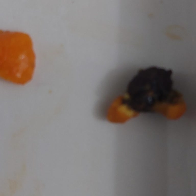 Çitlekçi Soslu Fıstıkta Zeytin Çekirdeği Bulunması Diş Kırılma Ve Sağlık Riski Yaratıyor