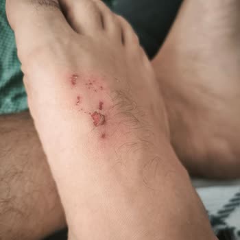 Boyner'den Aldığım Adidas Ayakkabının Kısa Sürede Deforme Olması Ve İade İsteği