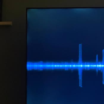 Grundig TV Panel Kusuru Ve Servis Reddi