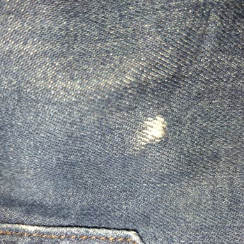 USPA Kot Pantolonunda Üretim Hatası Ve Yanıltıcı İade Kararı
