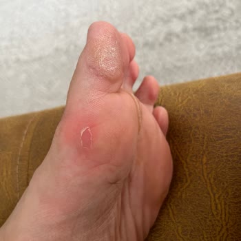 Skechers Beyaz Model Ayakkabının Sert Tabanı Nedeniyle Şiddetli Ayak Ağrısı Ve İade Talebi