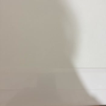 Çamaşır Makinesi Verimsiz, Servis Çözüm Üretmiyor Ve Fiziksel Hasar Görmüş