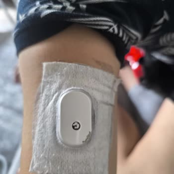 Çocuğumuz İçin Kullanılan Sensörlerin Yapışmazlığı Nedeniyle Kayıp Ve Yetersiz Müşteri Desteği