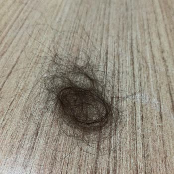 Duru Nem Bombası Şampuanı Saç Dökülmesi Ve Şiddetli Kaşıntıya Neden Oluyor