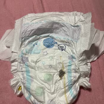 Bebek Bezinde Yabancı Cisim Bulunması Üzerine Şikayet Ve Açıklama Talebi
