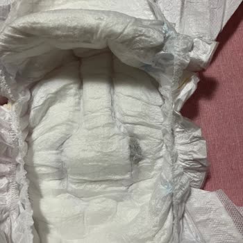 Bebek Bezinde Yabancı Cisim Bulunması Üzerine Şikayet Ve Açıklama Talebi