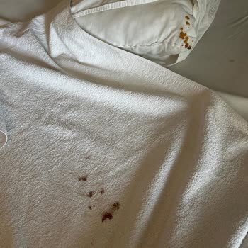 Club Ürgenç Hotelde Hijyen Ve Bakım Sorunları, Tatilbudur’un İlgisiz Yaklaşımı
