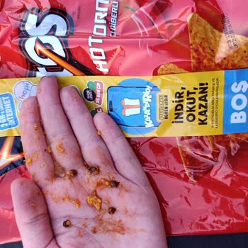Doritos Hot Corn Ürününde Metal Toplar Çocuğumun Dişine Çatlak Açtı