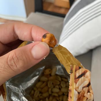 Simbat Kızartılmış Yer Fıstığında Sert Yabancı Cisim Diş Hasarı Ve Güvenlik Riski