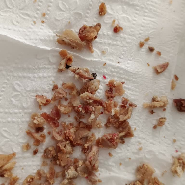 Has Kokoreç'te Çıplak Elle Hijyen İhlali Ve Plastik Parça Kontaminasyonu